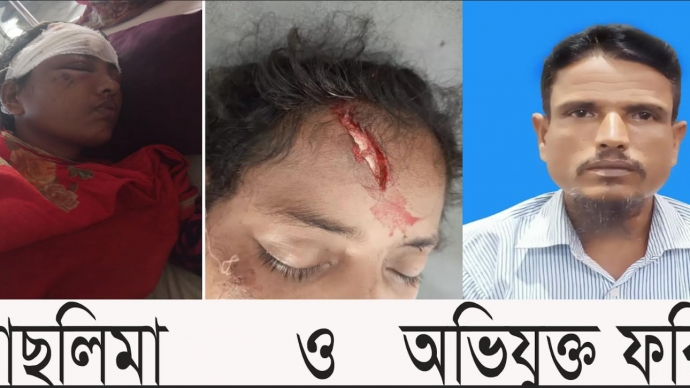 ছেলে মাকে মারছে, ধরতে গেলে ইট মেরে ভাবির কপাল ফাটিয়ে দিল দেবর ফরিদ।।লালমোহন বিডিনিউজ